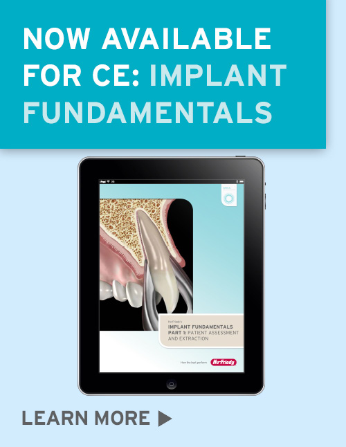 Implant Fundamentals